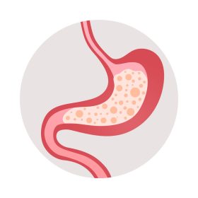 Gastritis (gyomorhurut)